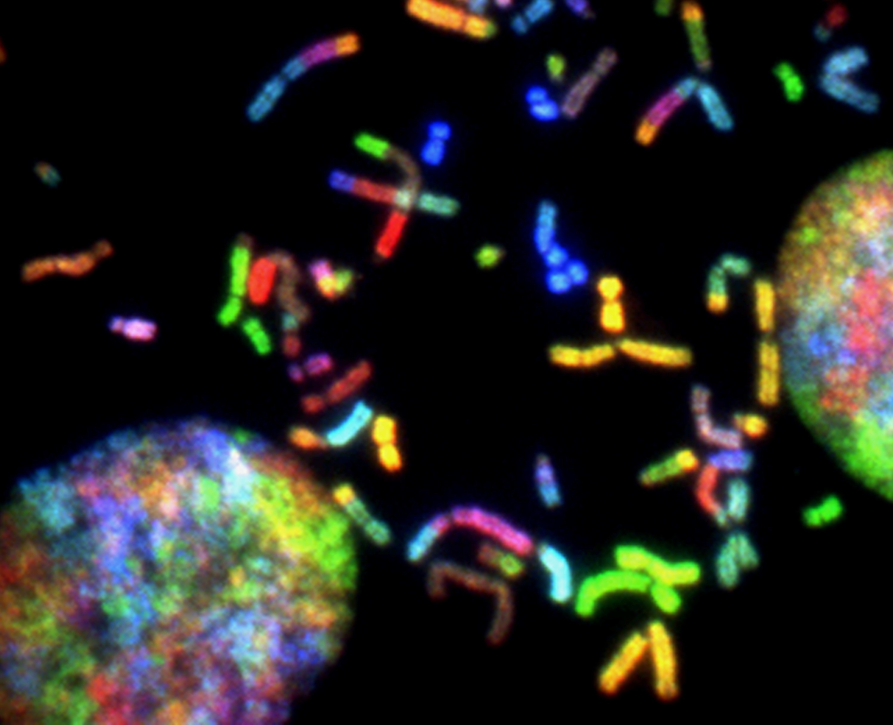 The human reference genome is finally complete