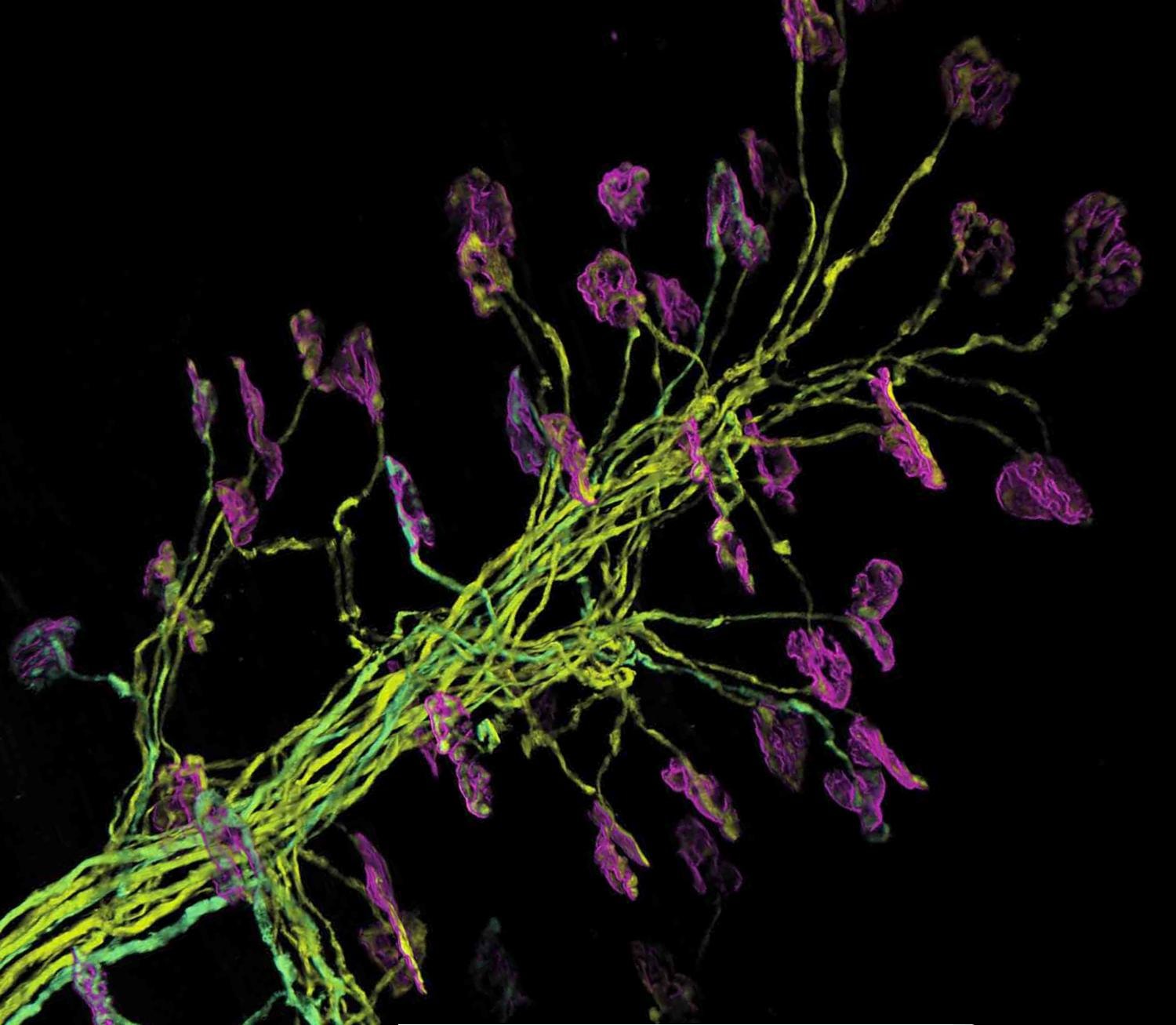 A new promising therapy against Amyotrophic Lateral Sclerosis