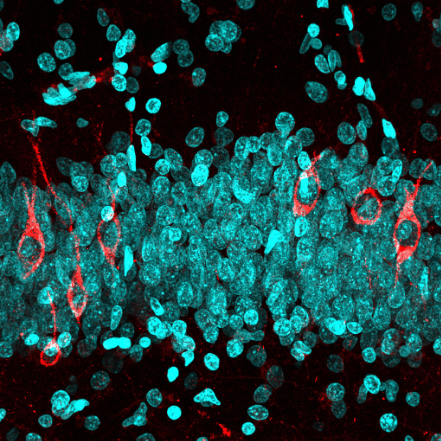 Hunting new-born neurons in the human adult brain