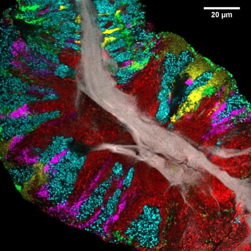Microbial life on our tongue