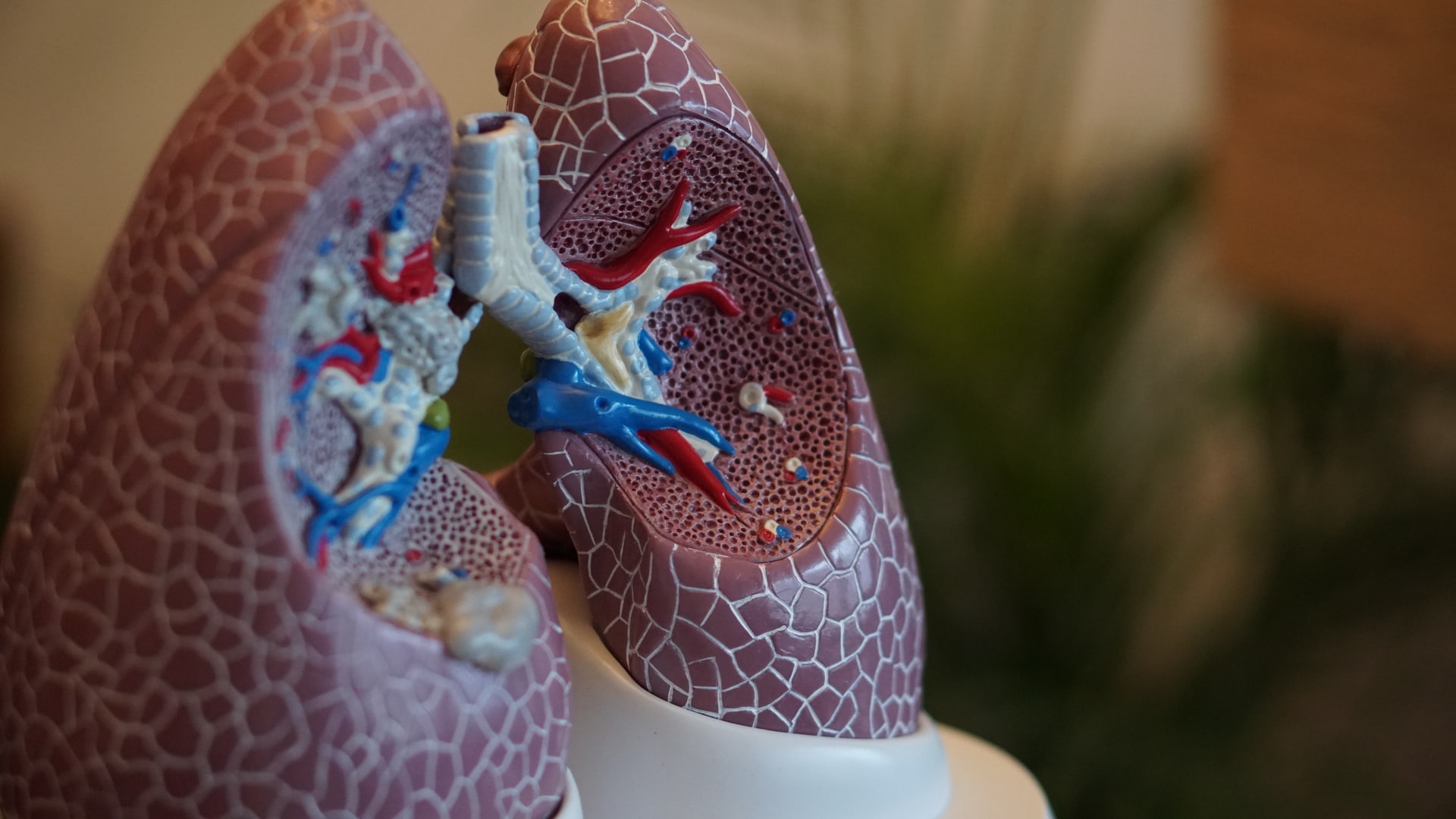 Shining a light on first contact in tuberculosis