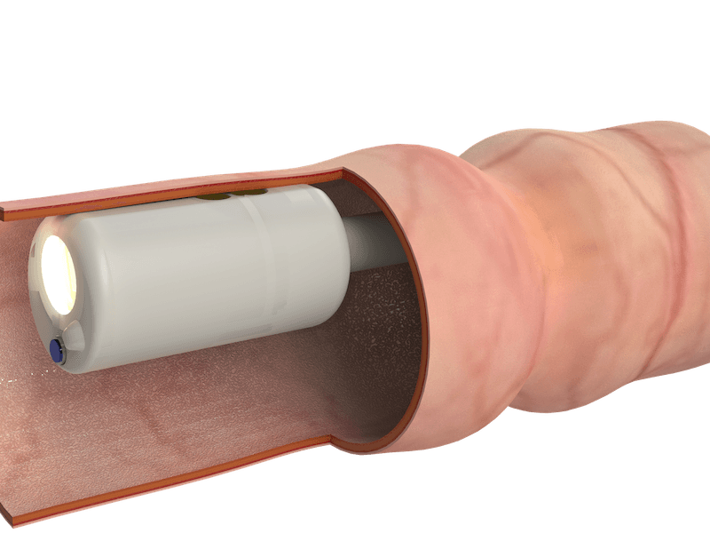 A robotic capsule to explore the gastrointestinal tract