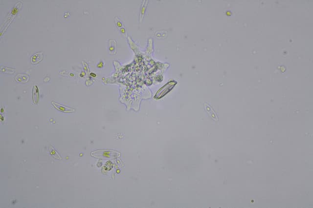 Amoebas trap bacteria using nets of DNA: the same mechanism as human immune cells