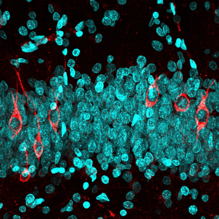Hunting new-born neurons in the human adult brain
