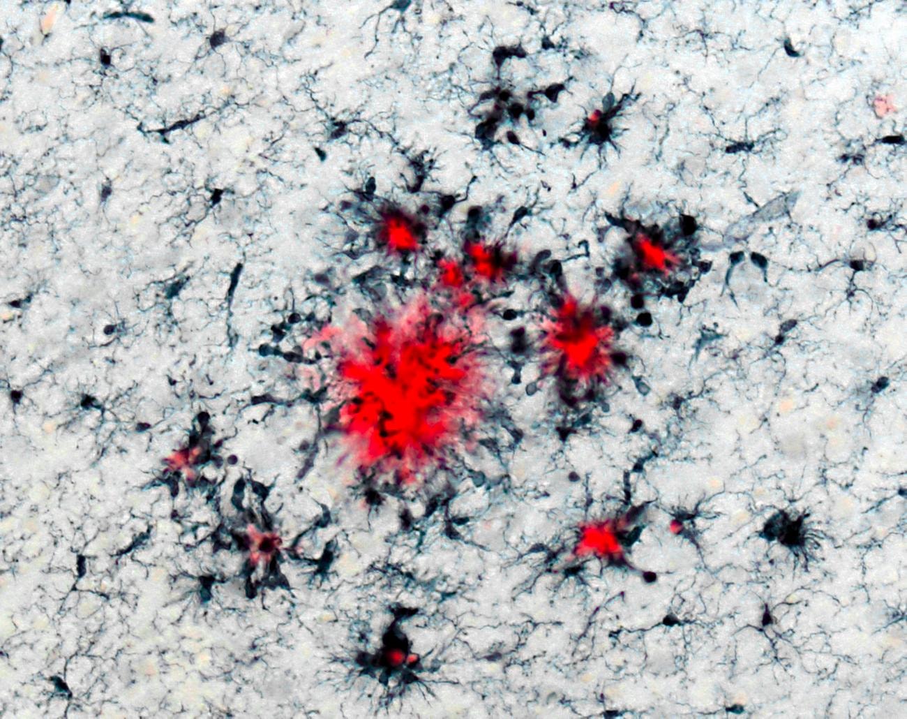 Innate immune memory – microglia as key players