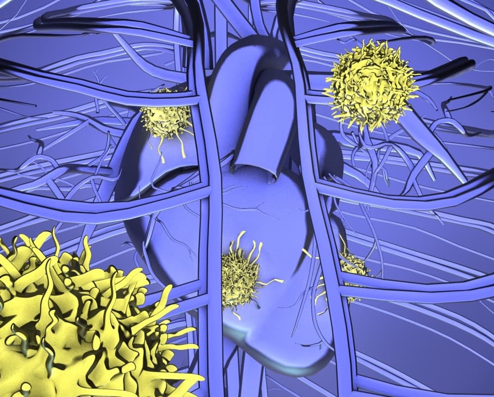 Taking cardiac fibrosis down with engineered immune cells