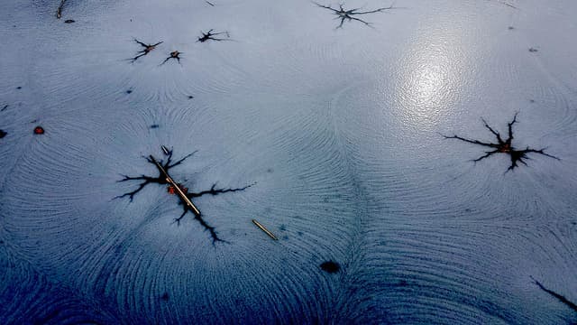 The power of our adaptive immunity against Alzheimer’s Disease