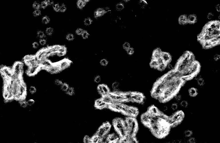 Vicious Circles – how changes in the shape of DNA can drive cancer