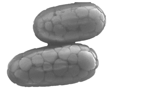 When it comes to the giant bacterium Achromatium, everything is everywhere