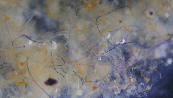 Textile fibers entangled with plankton and other organic matter in seawater samples.