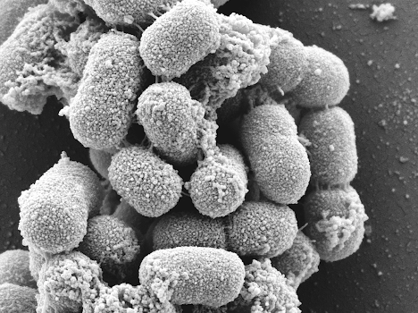 Scanning electron microscope image of Acinetobacter baumannii. AceI is naturally expressed on the surface of these bacteria.